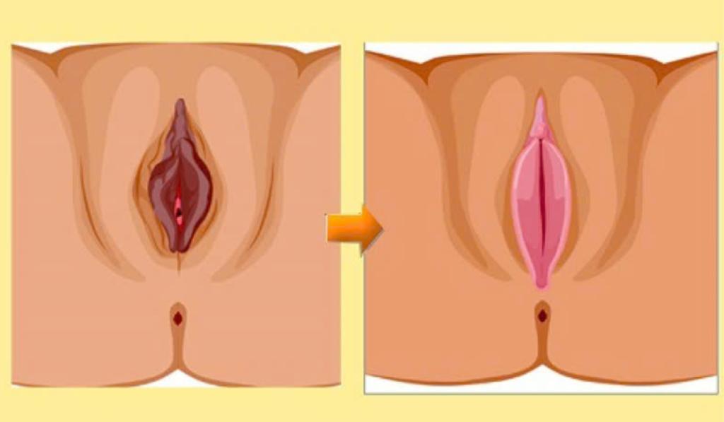 môi cô bé như thế nào là đẹp