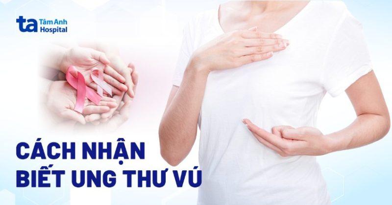 Phụ nữ tự kiểm tra vú để phát hiện sớm hình ảnh bệnh ung thư vú