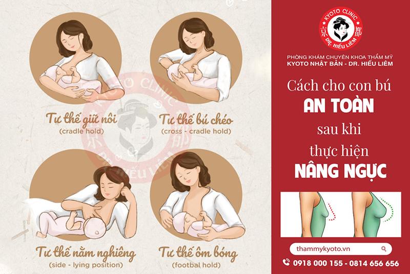 Làm ngực cho con bú được không - Tư thế cho con bú an toàn sau nâng ngực