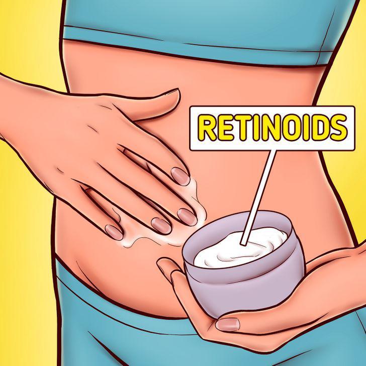 Chị em chán nản vì bụng bèo nhèo, chảy xệ sau sinh, hãy thử ngay những cách này! - 2