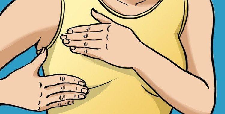 Sưng vú, căng đau ngực là những triệu chứng bình thường trong kỳ kinh nguyệt