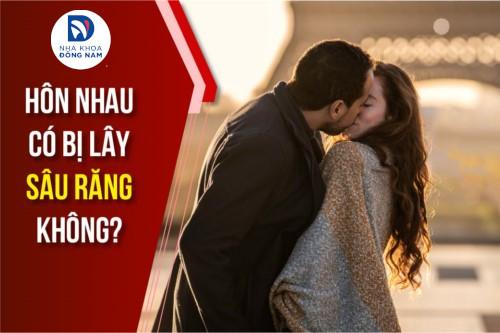 Hôn Nhau Có Bị Lây Sâu Răng Hay Không
