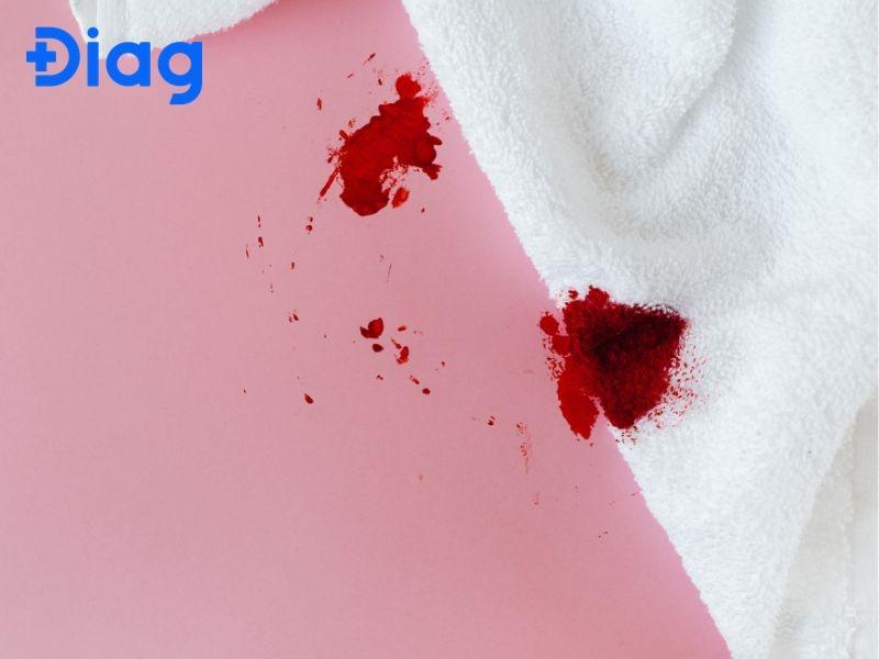 Khi làm móng bị chảy máu vẫn có nguy cơ thấp bị nhiễm HIV nhưng cần đạt đủ điều kiện là virus HIV còn tồn tại.