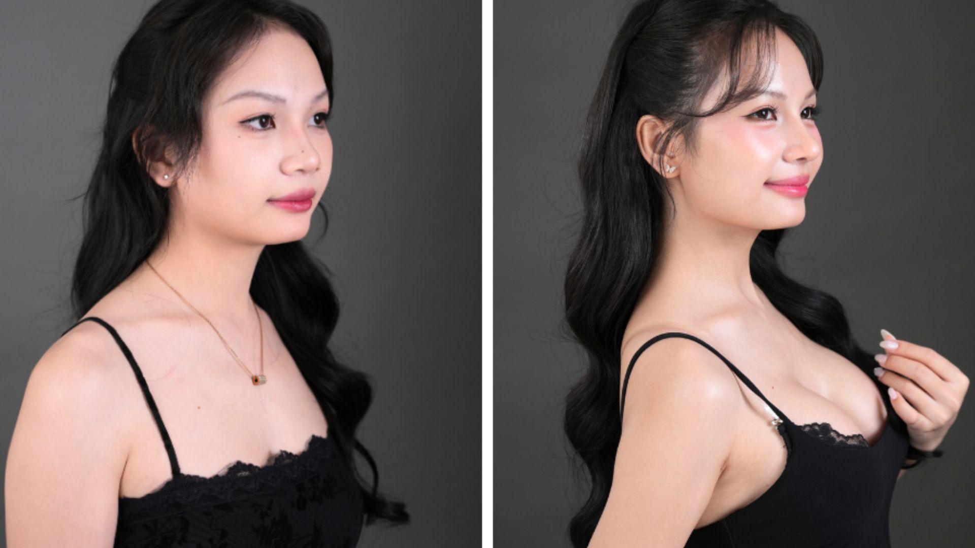 Bệnh viện Thẩm mỹ Nam An - nơi nhiều khách hàng tin tưởng lựa chọn (1)